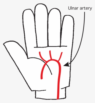 Hand