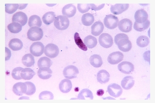 Request Pricing Info - Plasmodium Falciparum Microgametocyte