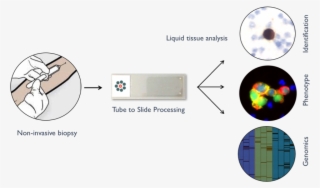 Ctcs Can Be Detected In Peripheral Blood Using A Simple, - Circle
