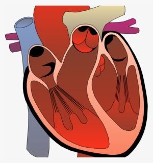 Real Heart - Right Ventricular Outflow Tract Ectopy
