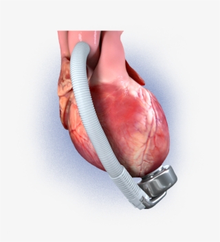 A Standard Implantation Procedure - Injury