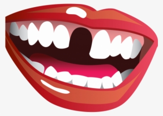 Missing Teeth Cliparts - Missing Teeth Smile Png