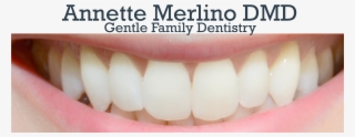 Annette Merlino, Dmd Logo - Tooth