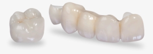 Prismatik Clinical Zirconia™ - Zirconia Crowns Dental Png