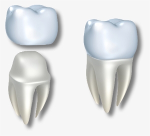 Dental Crown Transparent