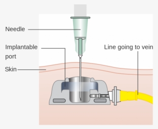 To Help Better Understand And Get A Visual Of What - Diagram