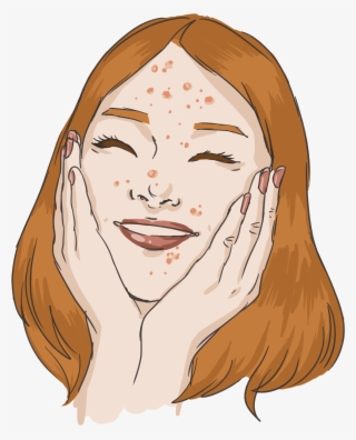 Your Pimples Are Cute