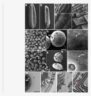Sem And Tem Observation For The Wt And Oslap6 Anther - Monochrome