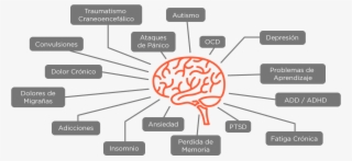 Cerebro - Diagram